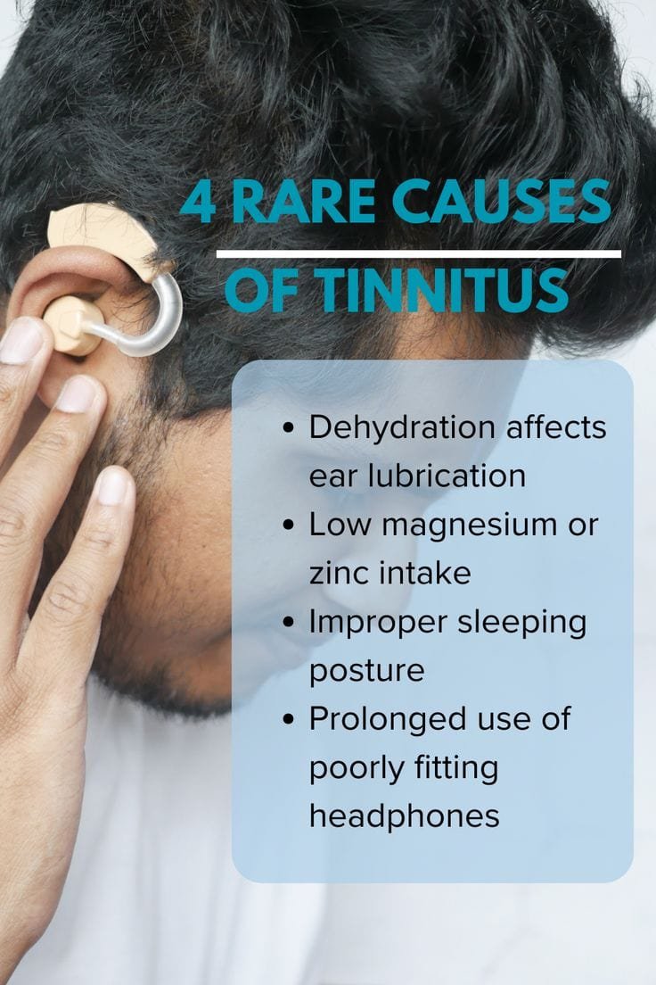 4 Rare Causes of Tinnitus You Should Know